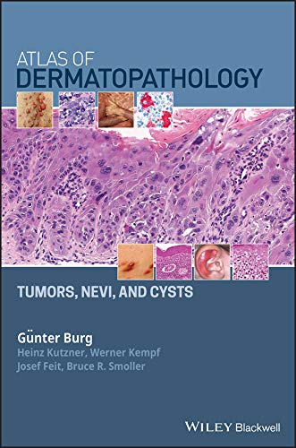 (eBook PDF)Atlas of Dermatopathology: Tumors, Nevi, and Cysts by Gunter Burg , Heinz Kutzner , Werner Kempf , Josef Feit , Bruce R. Smoller 