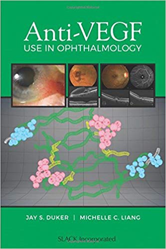 (eBook PDF)Anti-VEGF Use in Ophthalmology-1 by Jay S Duker MD , Michelle C. Liang MD