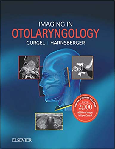 (eBook PDF)Imaging in Otolaryngology by Richard K. Gurgel , H. Ric Harnsberger 