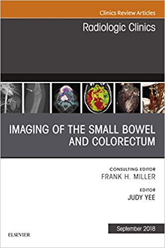 (eBook PDF)Imaging of the Small Bowel and Colorectum by Judy Yee 