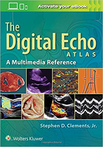(eBook PDF)The Digital Echo Atlas, A Multimedia Reference by Stephen D. Clements Jr. MD 