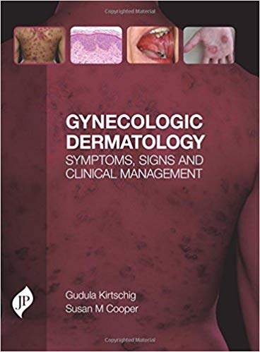 (eBook PDF)Gynecologic Dermatology: Symptoms, Signs and Clinical Management by Gudula, M.D., Ph.D. Kirtschig , Susan M., M.D. Cooper 