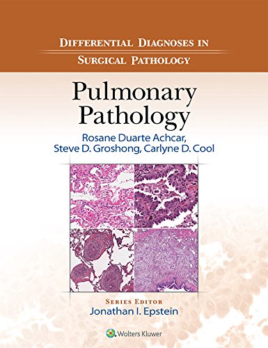 (eBookHTML)Differential Diagnoses in Surgical Pathology Pulmonary Pathology by Rosane Duarte Achcar , Steve D. Groshong , Carlyne D. Cool 