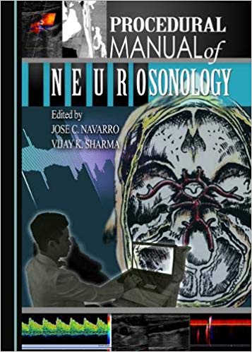 (eBook PDF)Procedural Manual of Neurosonology by Jose C. Navarro, Vijay K. Sharma 