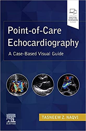 (eBook PDF)Point-of-Care Echocardiography by Tasneem Z. Naqvi 