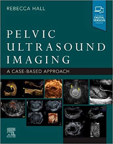 (eBook PDF)Pelvic Ultrasound Imaging A Cased-Based Approach by Rebecca Hall PhD RDMS FSDMS 