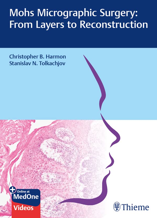 (eBook PDF)Mohs Micrographic Surgery From Layers to Reconstruction by Christopher B. Harmon,Stanislav N. Tolkachjov