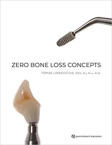 (eBook PDF)Zero Bone Loss Concepts