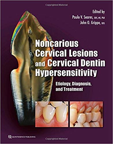 (eBook PDF)Noncarious Cervical Lesions and Cervical Dentin Hypersensitivity: Etiology, Diagnosis, and Treatment 1st Edition