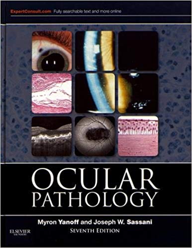 (eBook PDF)Ocular Pathology, 7th Edition by Myron Yanoff MD , Joseph W. Sassani MD MHA 