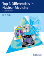 (eBook PDF)Top 3 Differentials in Nuclear Medicine by Ely Wolin