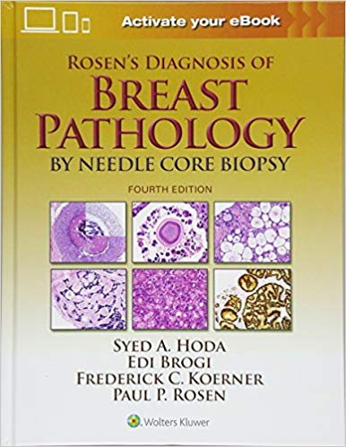 (eBook PDF)Rosen s Diagnosis of Breast Pathology by Syed A. Hoda MD , Paul Peter Rosen MD , Edi Brogi MD PHD , Frederick C. Koerner MD 