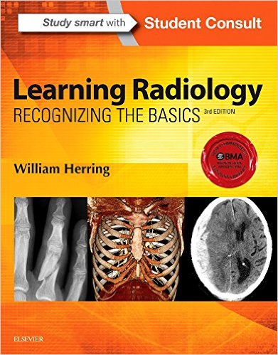 (eBook PDF)Learning Radiology - Recognizing the Basics, 3rd Edition by William Herring MD FACR 