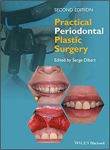 (eBook PDF)Practical Periodontal Plastic Surgery 2nd Edition by Serge Dibart 