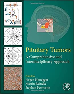 (eBook PDF)Pituitary Tumors A Comprehensive and Interdisciplinary Approach by Jürgen Honegger , Martin Reincke , Stephan Petersenn 
