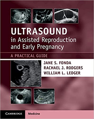 (eBook PDF)Ultrasound in Assisted Reproduction and Early Pregnancy by Jane S. Fonda , Rachael J. Rodgers , William L. Ledger 