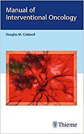 (eBook PDF)Manual of lnterventional Oncology by Douglas Coldwell 