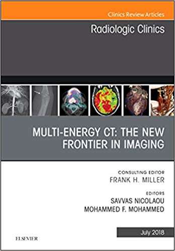 (eBook PDF)Multi-Energy CT The New Frontier in Imaging by Savvas Nicolaou M.D. ,  Mohammed F. Mohammed MD 