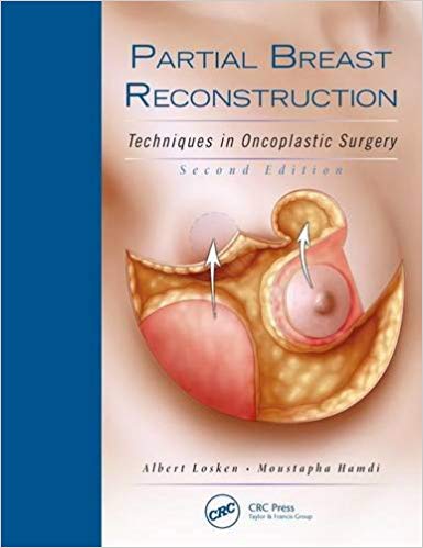 (eBook PDF)Partial Breast Reconstruction - Techniques in Oncoplastic Surgery, 2nd Edition + VIdeos by Albert Losken , Moustapha Hamdi 