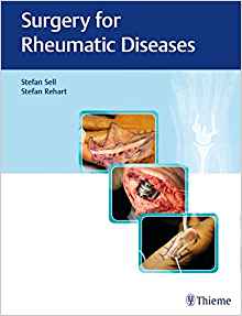 (eBook PDF)Surgery for Rheumatic Diseases by Stefan Sell , Stefan Rehart 