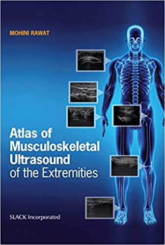 (eBook PDF)Atlas of Musculoskeletal Ultrasound of the Extremities by Mohini Rawat (author) 