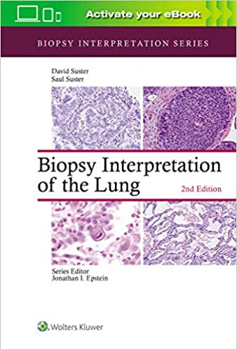 (eBook HTML)Biopsy Interpretation of the Lung (Biopsy Interpretation Series) 2nd Edition by Saul Suster MD , David Suster MD 