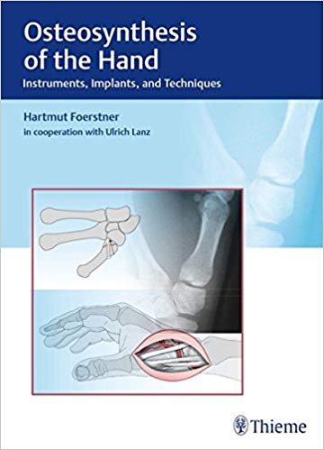 (eBook PDF)Osteosynthesis of the Hand - Instruments, Implants, and Techniques by Hartmut Förstner 