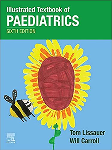 (eBook PDF)Illustrated Textbook of Paediatrics, 6th Edition by Tom Lissauer, Will Carroll 