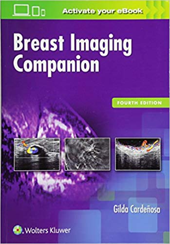 (eBook PDF)Breast Imaging Companion, 4th Edition by Gilda Cardenosa MD 