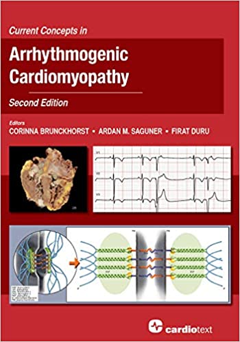 (eBook PDF)Current Concepts in Arrhythmogenic Cardiomyopathy, Second Edition by Corrinna Brunckhorst , Ardan M. Saguner , Firat Duru 