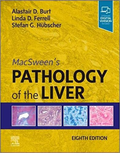 (eBook PDF)MacSween s Pathology of the Liver 8th Edition by Alastair D. Burt BSc MBChB MD FRCPath FRCPA FRCP FRSB FAHMS,Linda D. Ferrell MD