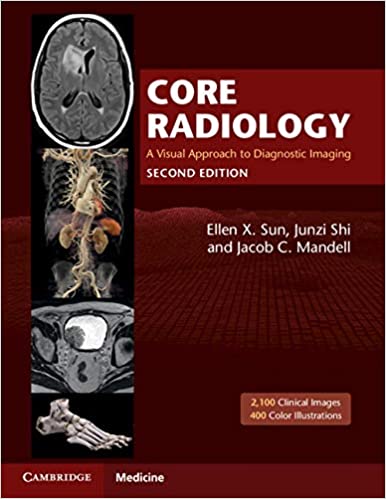 (eBook PDF)Core Radiology A Visual Approach to Diagnostic Imaging 2nd Edition 2 Volume Set by Ellen X. Sun , Junzi Shi , Jacob C. Mandell 