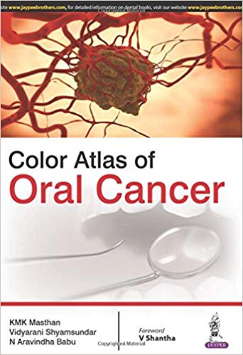 (eBook PDF)Color Atlas of Oral Cancer by Masthan K.M.K 