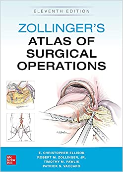 (eBook PDF)Zollinger s Atlas of Surgical Operations, 11th Edition by Robert Zollinger , E. Ellison , Timothy Pawlik , Gerard Doherty 