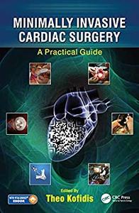 (eBook PDF)Minimally Invasive Cardiac Surgery: A Practical Guide by Theo Kofidis