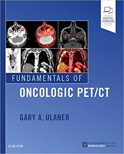 (eBook PDF)Fundamentals of Oncologic PET/CT (Fundamentals of Radiology) 1st Edition by Gary A. Ulaner MD PhD 