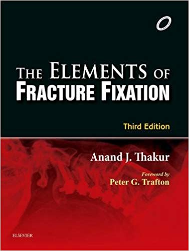 (eBook PDF)Elements of Fracture Fixation by Anand J. Thakur 
