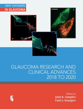 (eBook PDF)Glaucoma Research and Clinical Advances 2018 to 2020 by J.R. P.A. Samples Knepper 