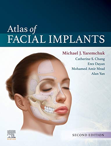 (eBook PDF)Atlas of Facial Implants, 2nd ed by Michael J. Yaremchuk MD 