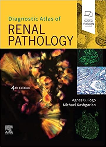 (eBook PDF)Diagnostic Atlas of Renal Pathology E-Book 4th Edition by Agnes B. Fogo , Michael Kashgarian 