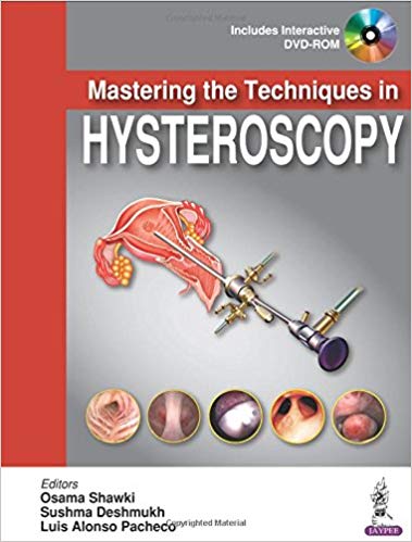 (eBook PDF)Mastering the Techniques in HYSTEROSCOPY by Osama, M.D. Shawki , Seshma, M.D. Deshmukh , Luis Alonso, M.D. Pacheco 