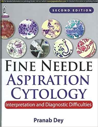 (eBook PDF)Fine Needle Aspiration Cytology Interpretation and Diagnostic Difficulties, 2E by Pranab Dey 