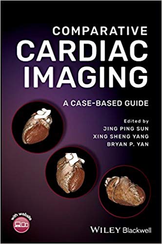 (eBook PDF)Comparative Cardiac Imaging by Jing Ping Sun,Xing Sheng Yang,Bryan P. Yan