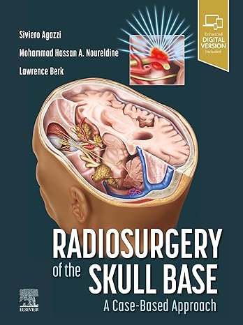 (eBook PDF)Radiosurgery of the Skull Base: A Case-Based Approach by Siviero Agazzi , Lawrence Berk , Mohammad Hassan A. Noureldine 