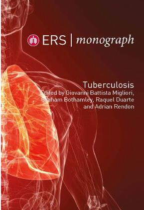 (eBook PDF)ERS Monograph 82 Tuberculosis