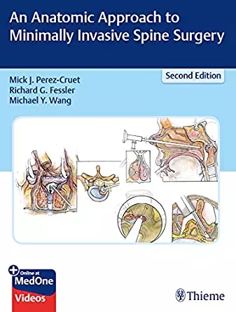 (eBook PDF)An Anatomic Approach to Minimally Invasive Spine Surgery 2nd Edition + 6.67GB VIDEOS by Mick Perez-Cruet , Richard Fessler , Michael Wang 