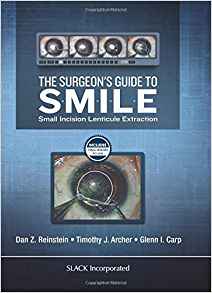 (eBook PDF)The Surgeon s Guide to SMILE by Dan Z. Reinstein , Timothy J. Archer , Glenn Carp 