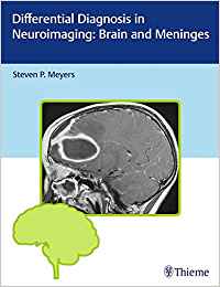 (eBook PDF)Differential Diagnosis in Neuroimaging - Brain and Meninges by Steven P. Meyers 