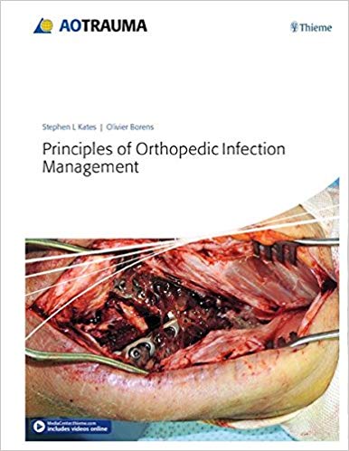 (eBook PDF)Principles of Orthopedic Infection Management + VIDEOS by Stephen Kates , Olivier Borens 