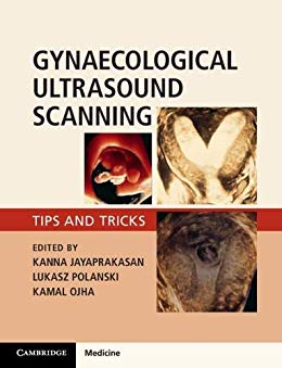 (eBook PDF)Gynaecological Ultrasound Scanning Tips and Tricks by Kanna Jayaprakasan , Lukasz Polanski , Kamal Ojha 